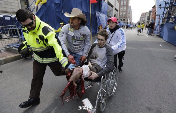 boston-marathon-bombing-man-missing-leg-wheelchair.jpg